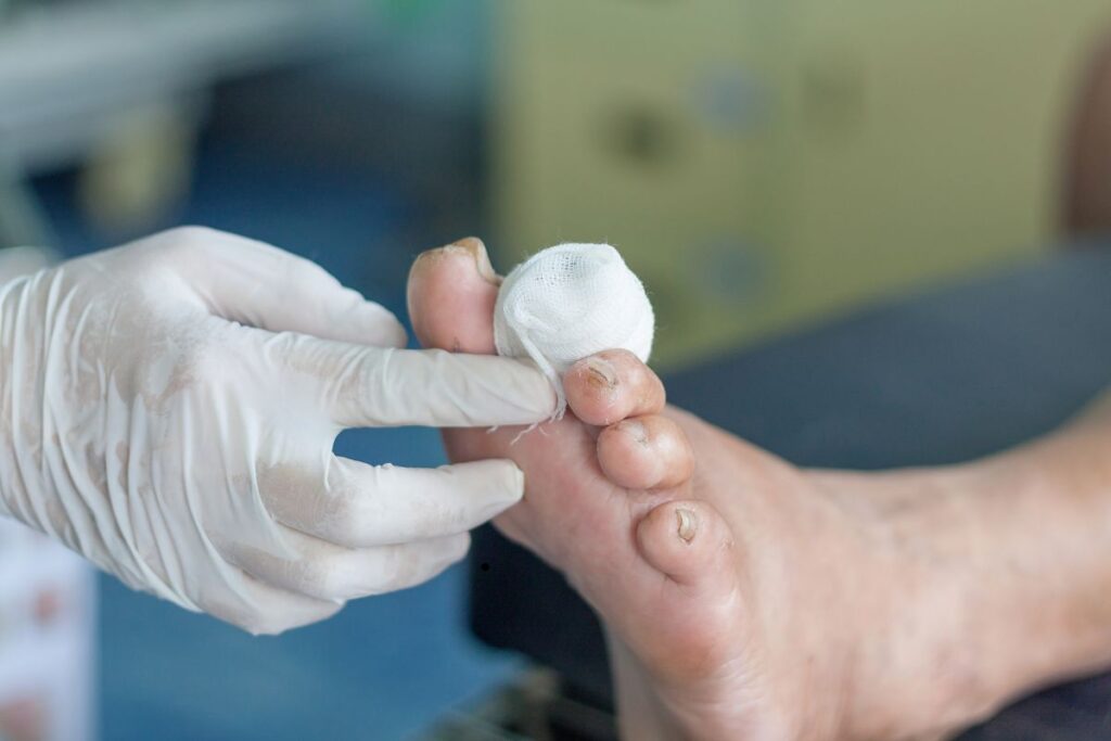 Chronic Wounds: When to Seek Specialized Care