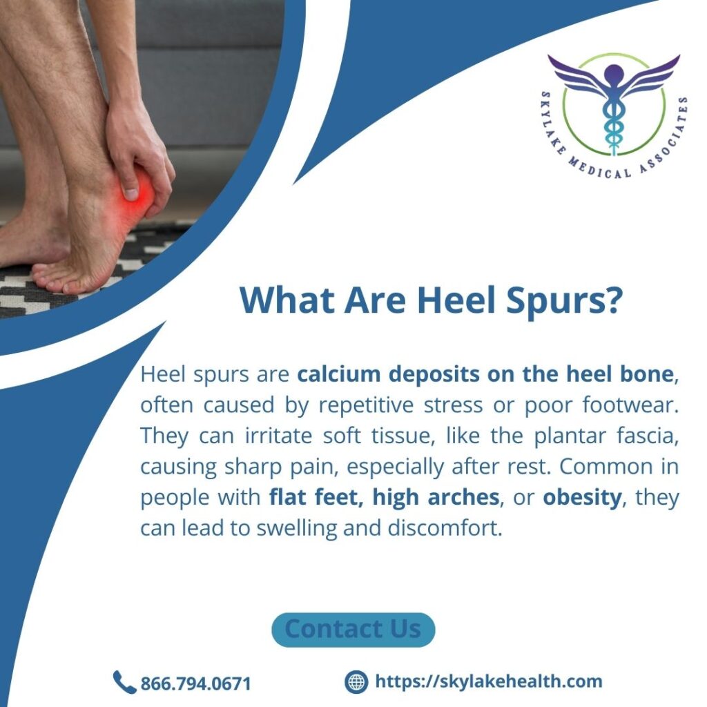 Heel Spurs: Pain Relief Strategies and When to See a Podiatrist