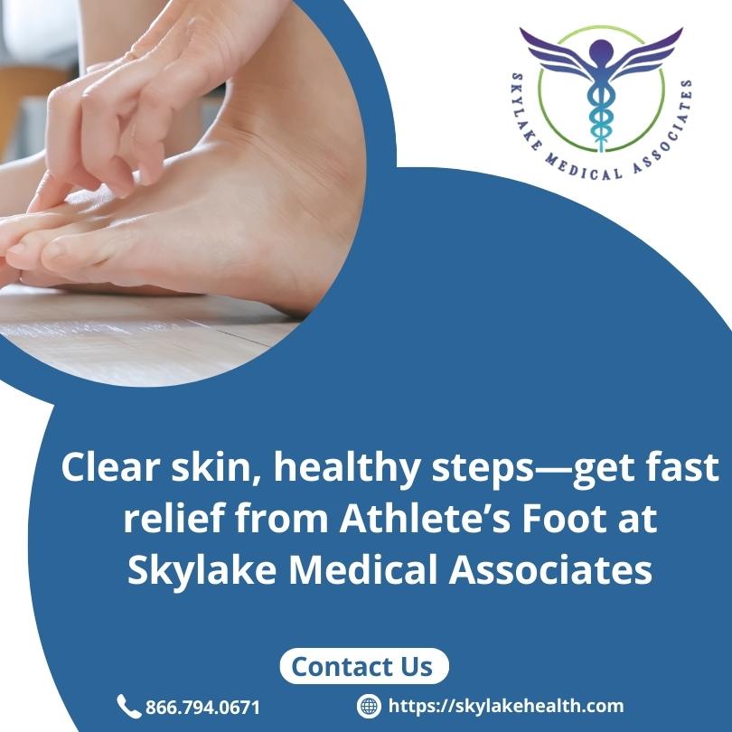 Athlete’s Foot: Identifying Fungal Infections and Treatment Solutions